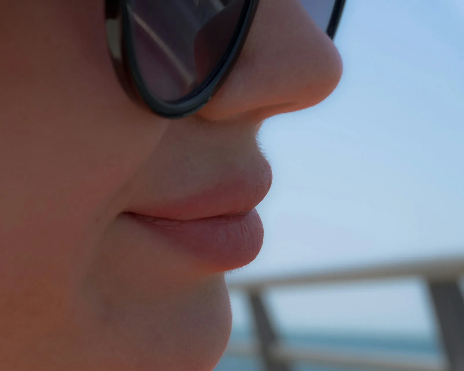 Nose bridge · mimikfalten